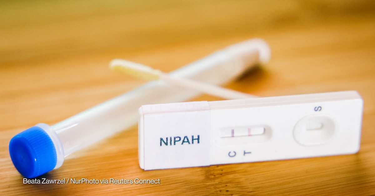 A stock 
photo depicting a laboratory test for the Nipah virus.